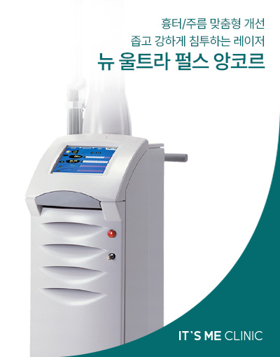 뉴 울트라 펄스 앙코르 썸네일